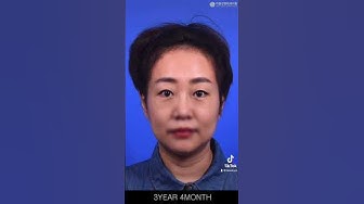 라봄성형외과 - Youtube