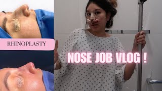 I GOT A NOSE JOB IN TIJUANA ! *RECOVERY + RESULT*