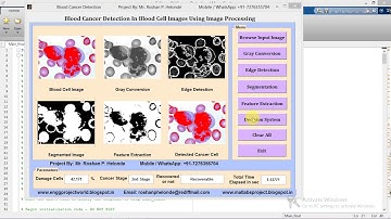 Matlab Code for Blood Cancer Detection and Classification Using Image Processing