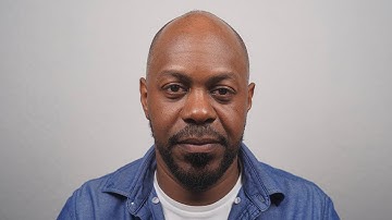 Jelly: Before + After Scalp Micro Pigmentation at The Scalp Shop