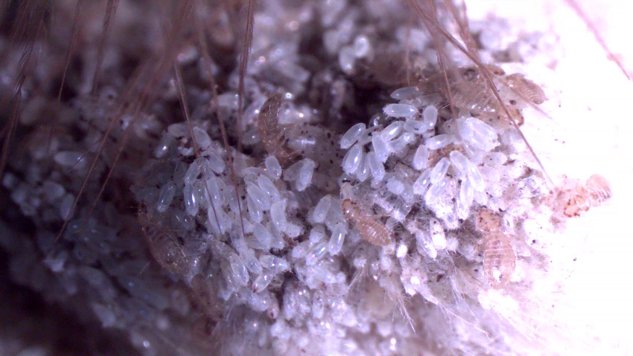 Chicken feather lice (Menopon spp.) YouTube