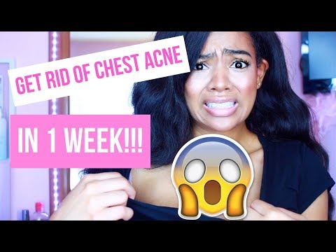 HOW TO GET RID OF CHEST ACNE FAST