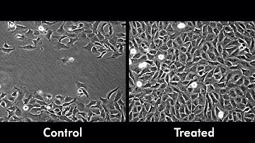 Rush to Heal: Novel Nanoparticle Therapy Promotes Wound Healing