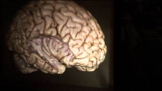 The Brain Surface: Sulci & Gyri by Guilherme Carvalhal Ribas, M.D.