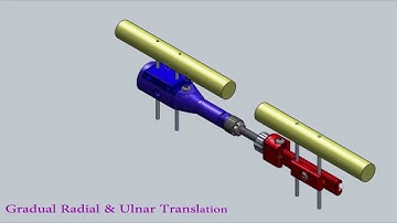 My Fix External Fixation System, Small