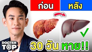 ไขมันพอกตับหายใน 1 เดือน‼️ ( 7 ขั้นตอน ง่าย ไม่ใช้ยา ทำได้จริง ) 😊❤️🌈 | หมอท๊อป 531