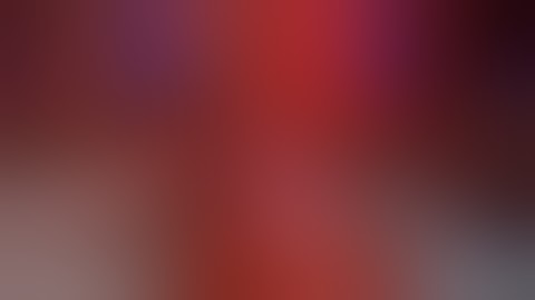 Right Robotic Pyeloplasty