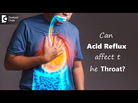 Video: Burning Throat: 9 Possibili Cause E Rimedi Da Provare