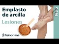 Emplasto de arcilla para esguinces, contusiones, inflamaciones y desgarros musculares