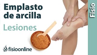 Arcilla verde antiinflamatoria en lesiones leves