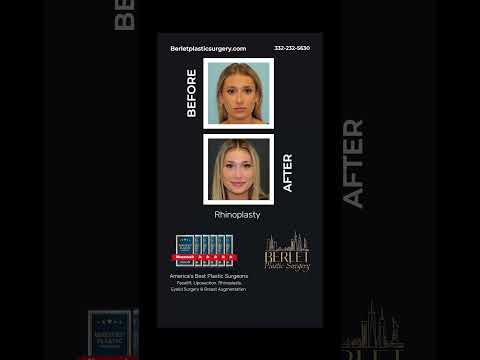 Video thumbnail: The Power of a Berlet Nose: Aesthetic Goals Activated #shorts #beforeandafter — Once Upon A Surgery