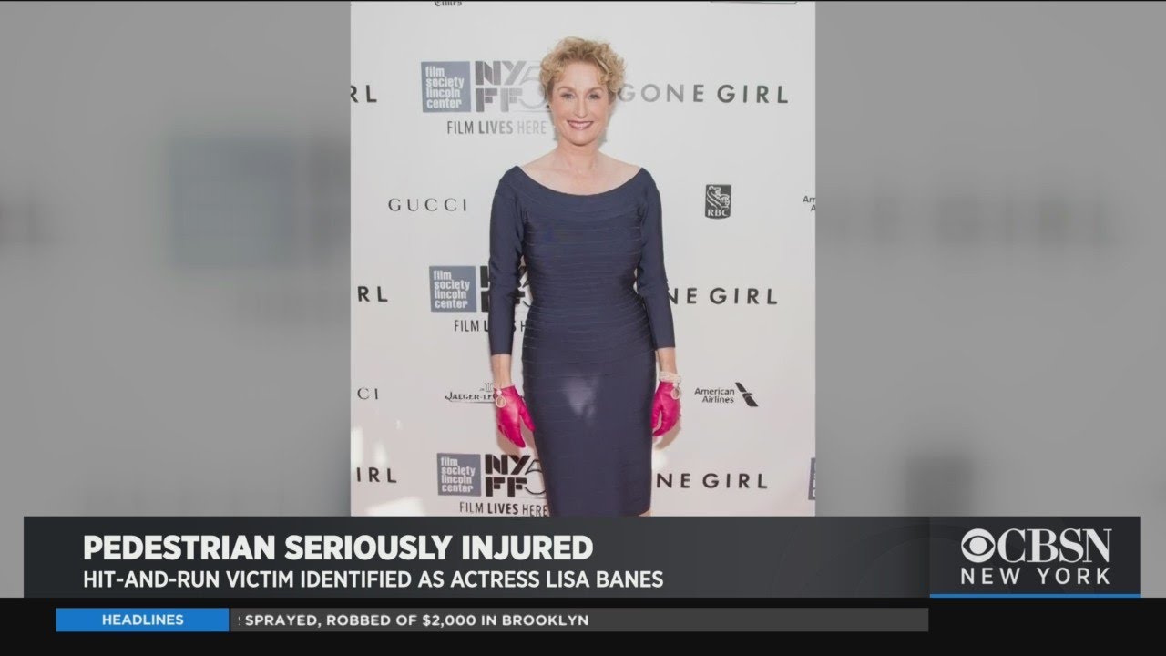 Gone Girl actor Lisa Banes hit-and-run seriously injured