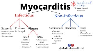 Myocarditis Explained - Heart Muscle Inflammation - Definition, Types, Causes, Symptoms, Treatment