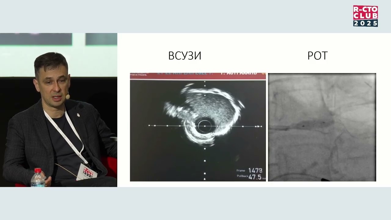 Визуализация при комплексных ЧКВ. Видеть главное / Ларионов Анатолий Александрович
