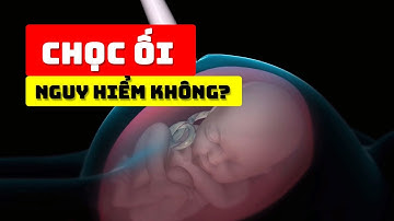Chọc ối có an toàn không? Khi nào nên làm xét nghiệm chọc ối?