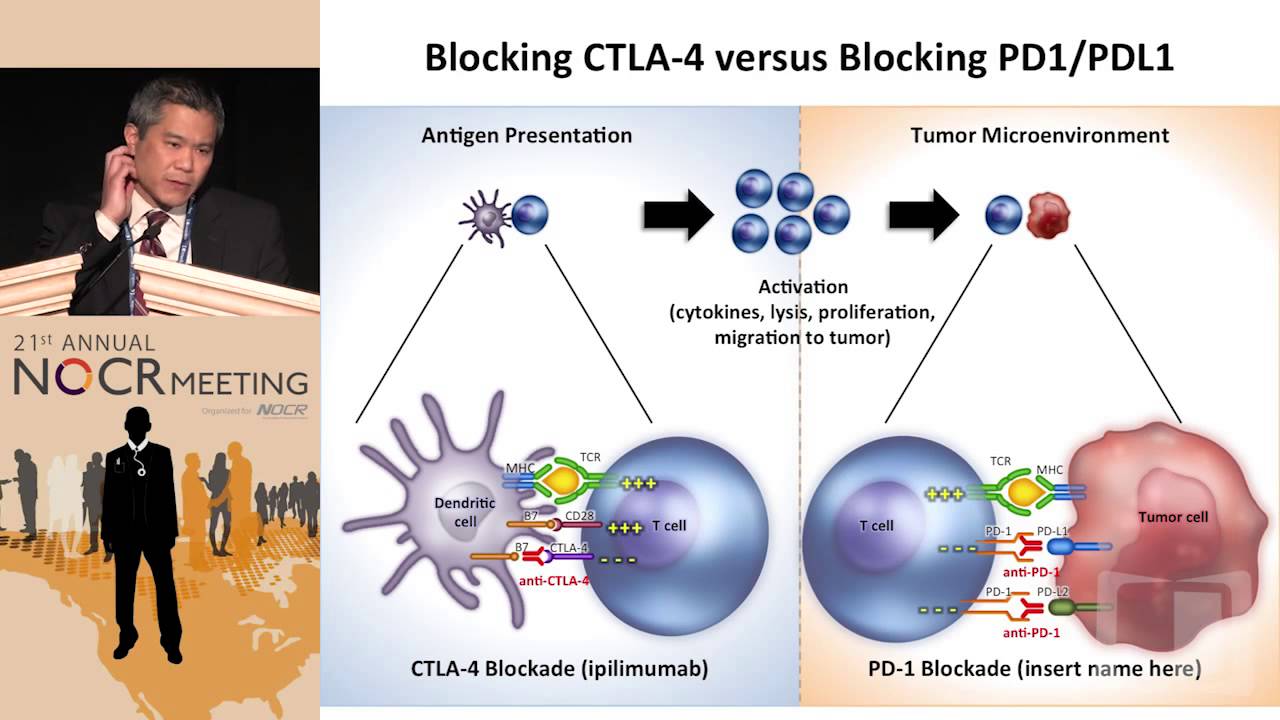 Advances in Immunotherapy for Melanoma YouTube