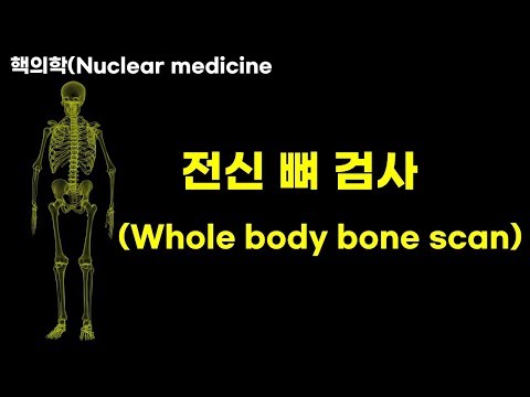 전신 뼈(암)검사 Whole body bone scan