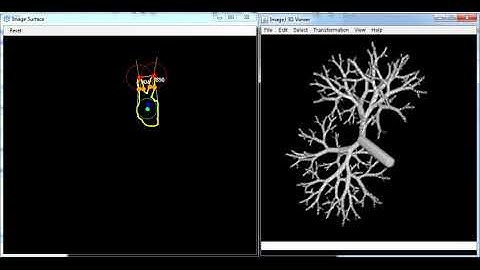 3D Model Controlling in ImageJ with the Gestures (Kinect)