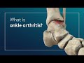 What is ankle arthritis?