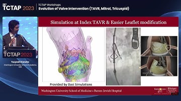 [TCTAP 2023] TCTAP Workshops - Evolution of Valve Intervention (TAVR, Mitral, Tricuspid)
