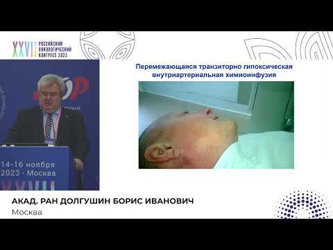 Интраартериальные технологии лечения плоскоклеточного рака головы и шеи