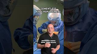 NO CEMENT Option for Severe Knee Pain Relief #shorts