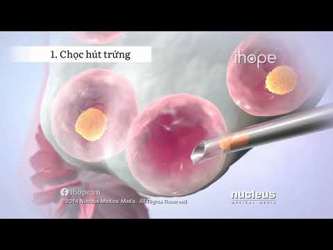 Thụ tinh nhân tạo IVF - Các bước làm thụ tinh trong ống nghiệm