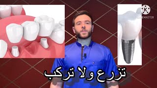الفرق بين التركيبات الثابته ( الكوبري ) وبين زراعة الاسنان