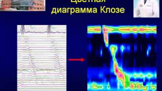 Трухманов А.С. Чикагская классификация нарушений моторики пищевода