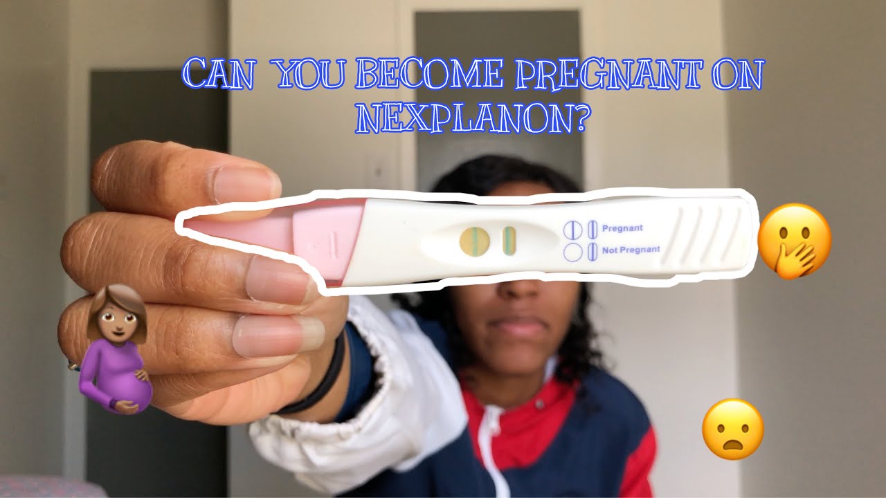 How I found Out I Was Pregnant On The Nexplanon Birth Control Implant