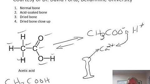 Lab 6 - Introduction to the Skeletal System - Bone Demo Videos