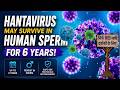 HANTAVIRUS MAY SERVIVE IN HUMAN SPERM FOR 6 YEARS