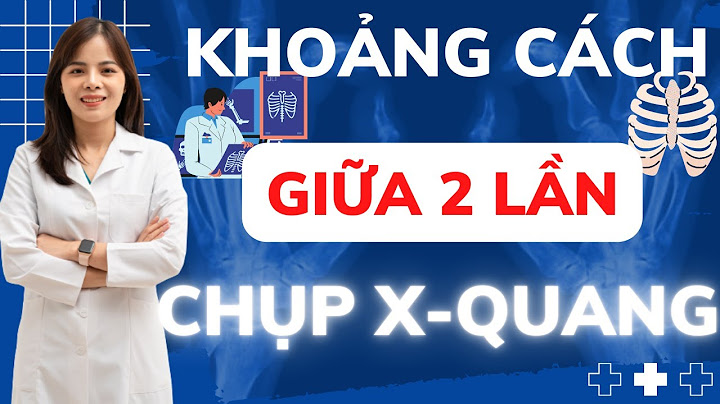 Chụp x quang lưng giá bao nhiêu năm 2024