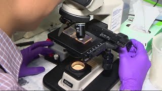 New tool to fight cancer gives patients hope
