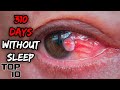 Top 10 Dark Things People Did Due To Insomnia - Part 3