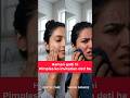 “90% Log Pimples Khud Laate Hai, 😱 In Mistakes Ki Wajah Se Hi Pimple Aate He, #skincare#pimple