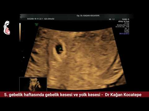 Video: 5 hafta hamile - ne beklenir
