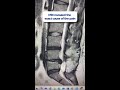 MRI-guided spinal decompression targets herniated disc angles X-ray can't see #MRI #BackPain