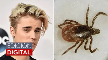 ¿Tiene Justin Bieber la enfermedad de Lyme?