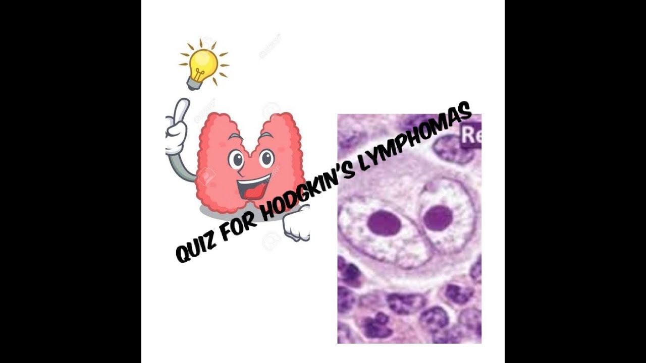 maxresdefault Do I Have Lymphoma Quiz
