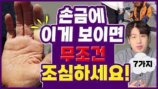 재물, 건강, 사업, 등 이런 손금은 반드시 조심하세요  조심해야될 손금 7가지