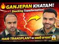 1 Din Ki Surgery Life Change! Hair Transplant Experience | Ganjepan khatam | Shocking Transformation