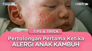 Penting Ini Pertolongan Pertama Yang Perlu Moms Lakukan Saat Alergi Anak Kambuh