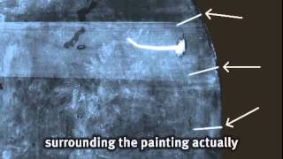 Conservation Focus: X-Ray -- Nails