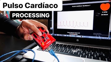 100 Latidos por Minuto - Pulso Cardíaco Arduino PCBWAY