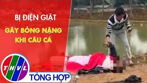 Bị điện giật gây bỏng nặng khi câu cá