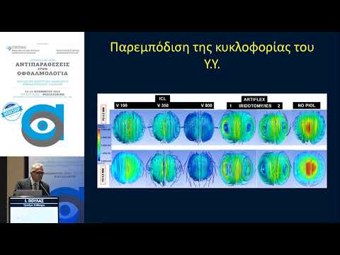 Ι. Πούλας  | Αντικατάσταση κρυσταλοειδούς φακού (RLE)