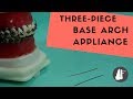 Three Piece Base Arch Appliance | Essential Biomechanics