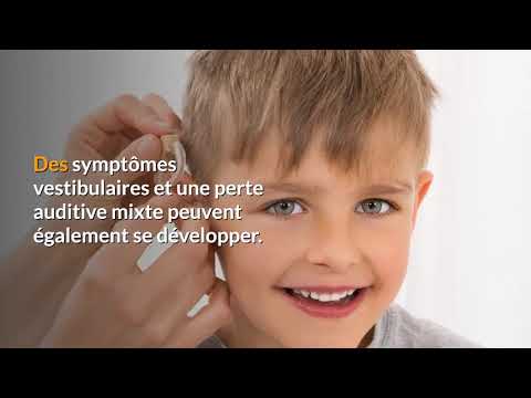 Vidéo: Expansion Du Phénotype Des Syndromes PRPS1 Chez Les Femmes: Neuropathie, Perte Auditive Et Rétinopathie