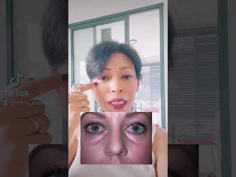 تجويف او الحفر تحت العين شد الوجه تجويف تحت العين يوغا مساج